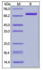 Rhesus macaque CD4, Fc Tag on SDS-PAGE under reducing (R) condition. The gel was stained overnight with Coomassie Blue. The purity of the protein is greater than 95%.